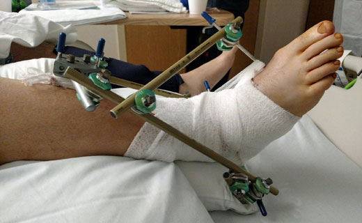 Subject in after Surgery